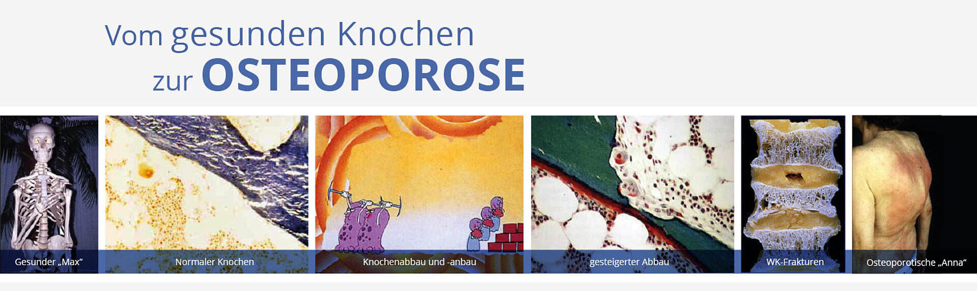 Osteologische Abteilung